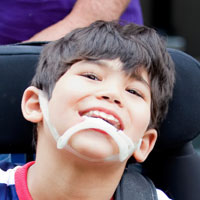 Special Needs Childrens Dentist Langley